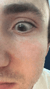 Eye Movement Test