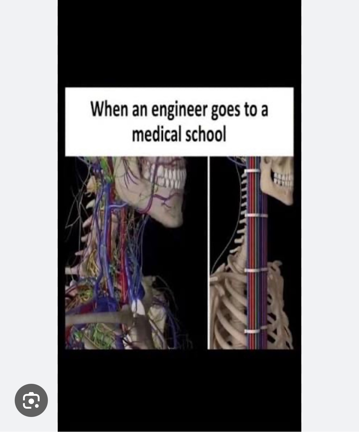Meme captioned "When an engineer goes to a medical school" comparing anatomy to a ribbon cable