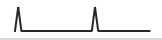 Wireshark activity sparkline for lo0 after unplugging the phone, with only two spikes